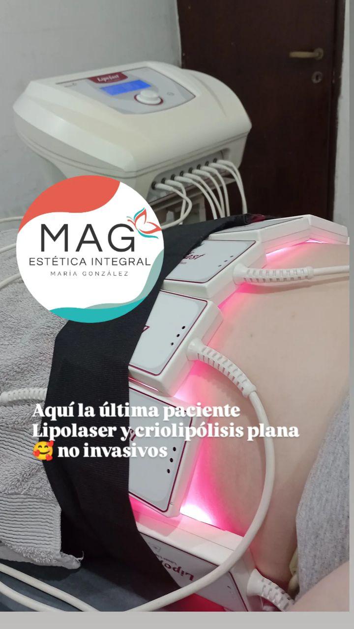 Aplicación de máscara botánica y peeling de algas en sesión facial